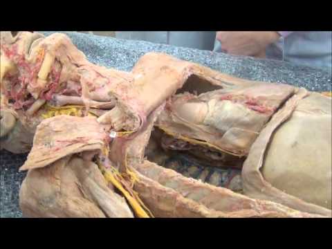 Видео: Строение средостения. Часть 1.