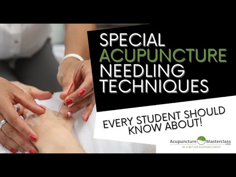 Видео: Специальные техники иглоукалывания, которые должен знать каждый специалист по акупунктуре