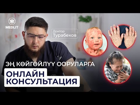 Видео: ОНЛАЙН КОНСУЛЬТАЦИЯ | ДОКТОР ТУРАБЕКОВ