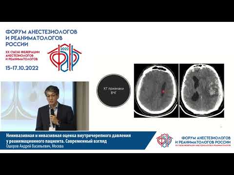 Видео: Неинвазивная и инвазивная оценка ВЧД в ОРИТ Ошоров А В