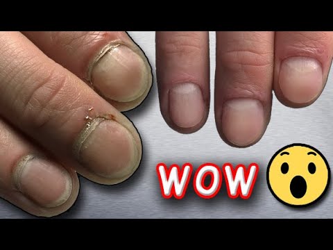 Видео: Жесткая Кутикула 😱 Маникюр на СЛОЖНЫХ руках.Преображение ногтей.Налипшая КУТИКУЛА.Аппаратный маникюр