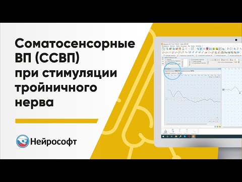 Видео: Соматосенсорные вызванные потенциалы (ССВП) при стимуляции тройничного нерва