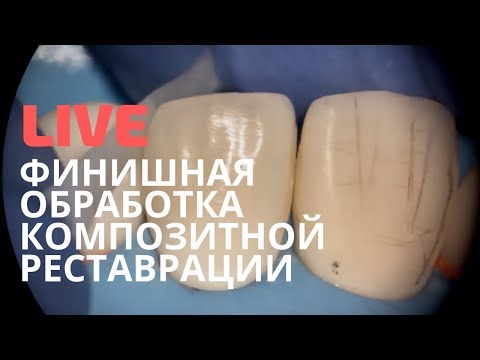Видео: Финишная обработка композитной реставрации. Прямой эфир в рамках Модуля 2: все о композитах.