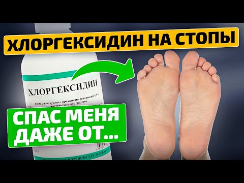 Видео: Лечит ноги и болезни - Хлоргексидин!