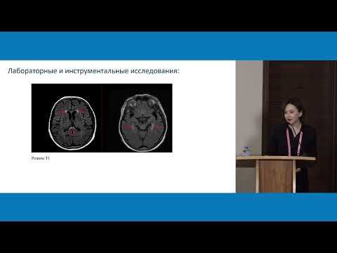 Видео: Разбор клинических наблюдений токсичности иммунотерапии. Головокружение от успехов