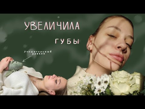 Видео: УВЕЛИЧИЛА ГУБЫ / мой первый опыт