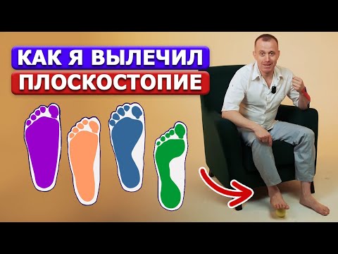 Видео: 2 упражнения от ПЛОСКОСТОПИЯ. Гимнастика для лечения и профилактики плоскостопия у взрослых и детей