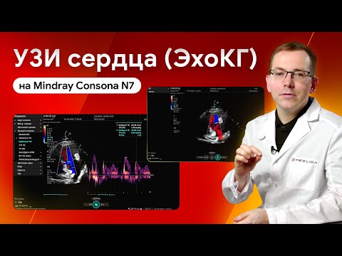 Видео: УЗИ сердца. Мастер-класс по эхокардиографии на Mindray Consona N7
