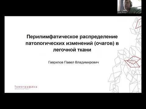Видео: Перилимфатическое распределение очагов при интерстициальном (диссеминированном) процессе в легких