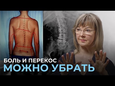 Видео: Перекос таза, короткая нога и асимметрия тела  Одна причина