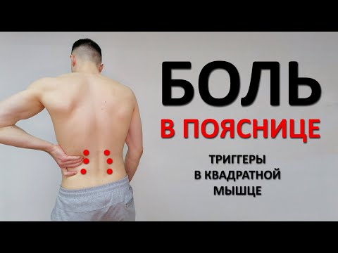 Видео: Боль в пояснице. Триггеры в квадратной поясничной мышце. Массаж и упражнения ЛФК