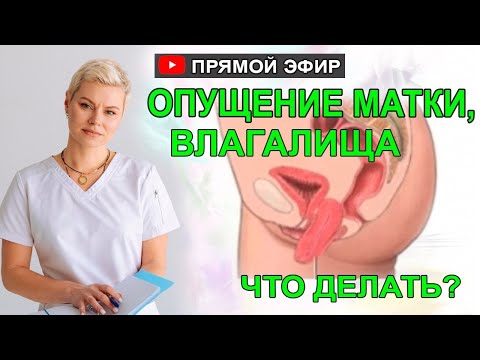 Видео: Опущение матки, и стенок влагалища что делать.  Врач Екатерина Волкова