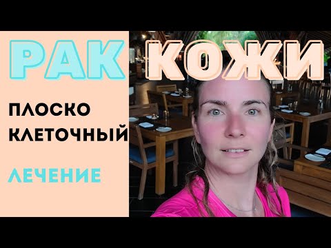 Видео: Рак кожи.Плоскоклеточный рак - ПРК. НЕ ПУТАТЬ с бородавкой. Самодиагностика. Виды Лечения и прогноз.