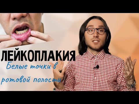 Видео: ЛЕЙКОПЛАКИЯ / Что делать / Как лечить
