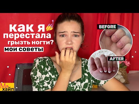 Видео: Как перестать грызть ногти || Вредные привычки