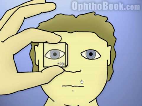 Видео: Офтальмология: тропии против форий