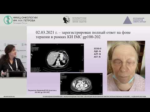 Видео: Увеальная меланома