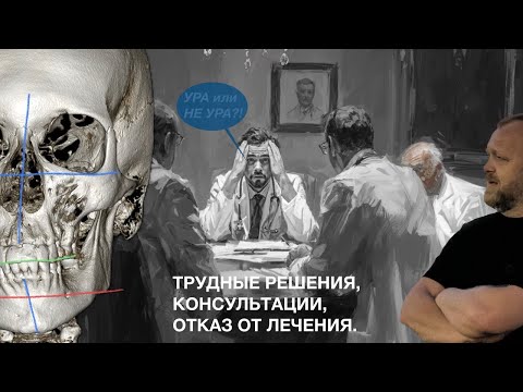 Видео: Асимметрия и боль лица - Неудачная консультация
