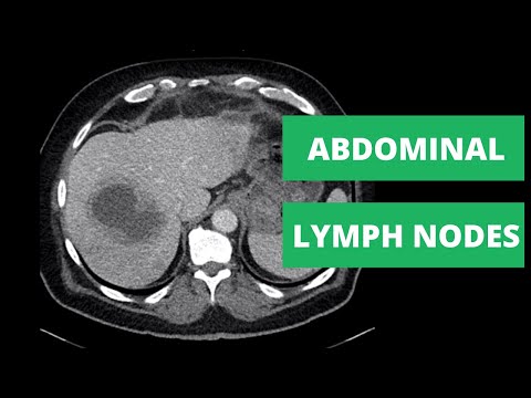 Видео: Станции КТ брюшной полости: лимфатические узлы — как читать КТ