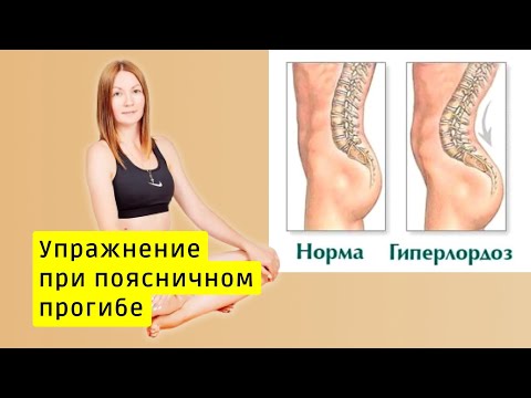 Видео: Упражнение при чрезмерном прогибе в пояснице – гиперлордозе