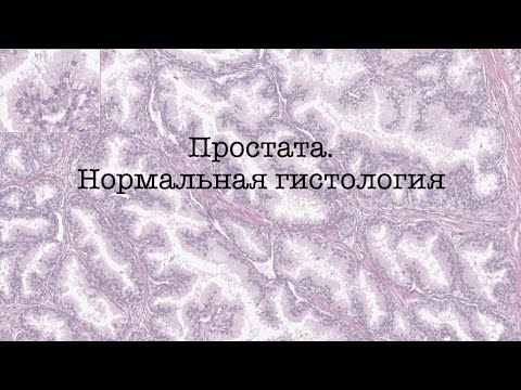 Видео: Простата. Нормальная гистология.