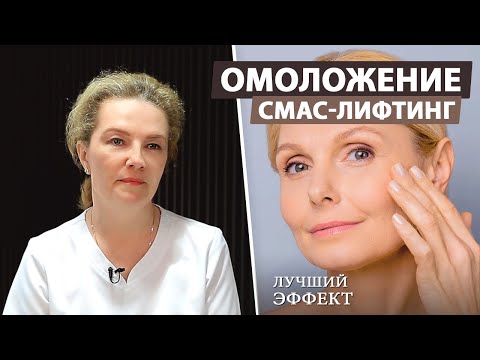 Видео: Что делает SMAS лифтинг лица?