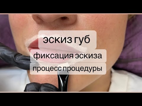 Видео: Эскиз перманента губ с помощью тонального крема ,фиксация эскиза ,анестезия ,процесс