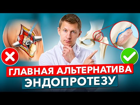 Видео: Новый метод лечения тазобедренного сустава БЕЗ замены на протез!