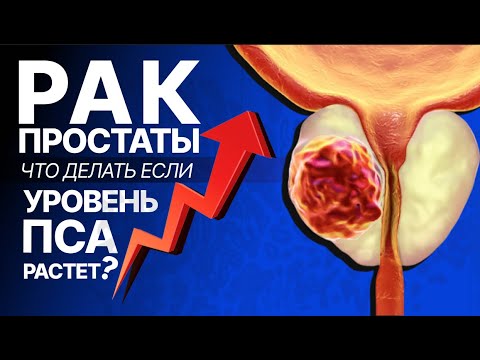 Видео: Рак простаты. Прогноз и факторы риска. Современные подходы к диагностике и лечению