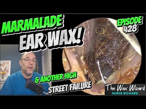 Видео: Ушная сера с мармеладом и ещё один провал на главной улице! Эпизод 428