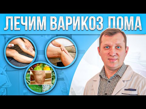 Видео: Как вылечить варикоз? Секреты врача.