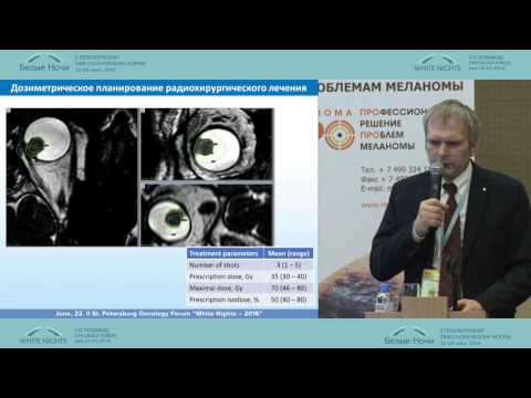 Видео: Взгляд радиолога: Радиохирургия на Гамма-Ноже в лечении меланомы сосудистой оболочки глаза