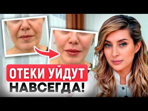 Видео: Отеки ИСЧЕЗНУТ за ОДНУ ночь! / Как БЫСТРО разогнать лимфу и избавиться от отечности?