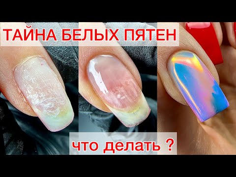 Видео: ТАЙНА БЕЛЫХ ПЯТЕН НА НОГТЕ #nails #ногти #гельлак #manicure