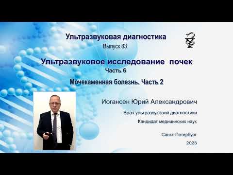 Видео: Ультразвуковая диагностика (УЗИ). Доктор Иогансен. Выпуск 83. Мочекаменная болезнь. Часть 2.