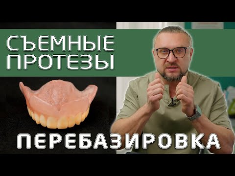 Видео: Перебазировка съемного зубного протеза. Для чего и когда делать перебазировку.