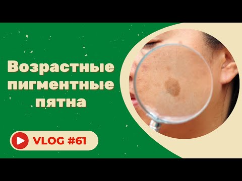 Видео: #61 Возрастные пигментные пятна