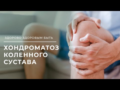 Видео: Как лечить хондроматоз?