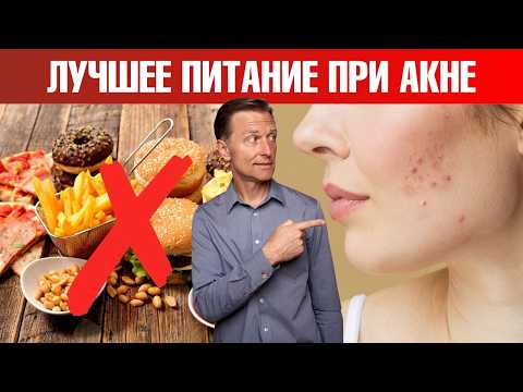 Видео: Как избавиться от акне быстрее всего?👀