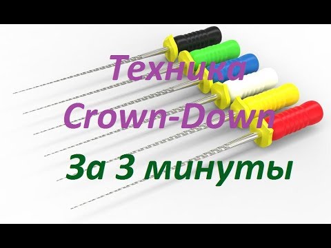 Видео: Эндодонтия.Техника Crown-Down за 3 минуты.