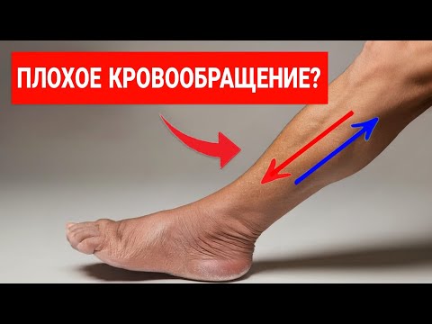 Видео: ВСЕГО 1 УПРАЖНЕНИЕ, КОТОРОЕ ВАМ НУЖНО ДЛЯ УЛУЧШЕНИЯ КРОВООБРАЩЕНИЯ В НОГАХ