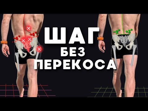 Видео: Каждый шаг с перекосом таза — это удар в поясницу. Время исправить походку.