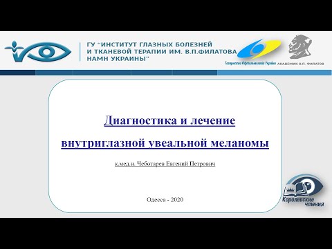 Видео: Диагностика и лечение внутриглазной увеальной меланомы