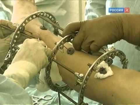 Видео: Гавриил Илизаров - Кудесник из Кургана. Гении и злодеи.