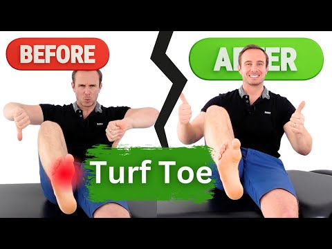 Видео: Облегчение боли в пальцах ног: домашние методы лечения, которые помогут вам снова ходить