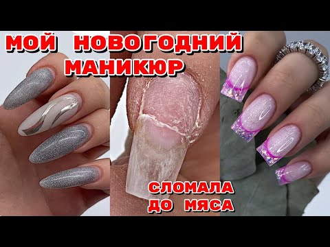 Видео: СОРВАЛА НОГОТЬ 😩 Мой новогодний маникюр 💅 Выкладной френч БЫСТРО