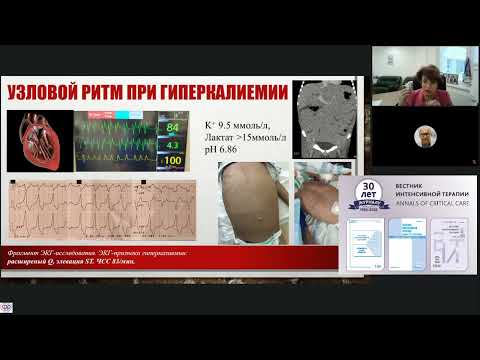Видео: Нуне Матинян: интенсивная терапия жизнеугрожающих состояний в детской онкологи / journal_vit
