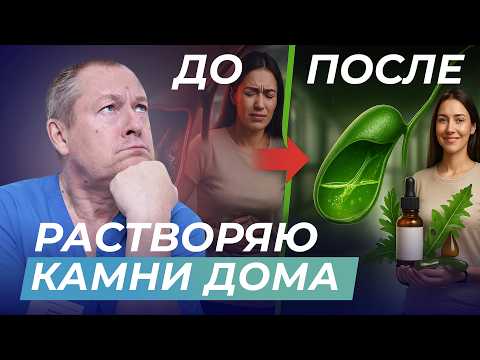 Видео: Камни в желчном пузыре. Причина, о которой молчат врачи.