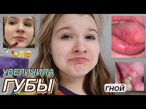 Видео: как я УВЕЛИЧИЛА ГУБЫ ;)