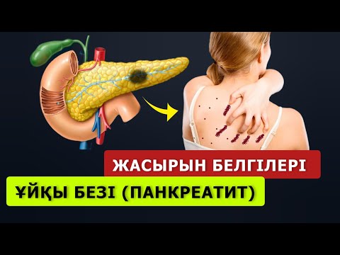 Видео: Мына БЕЛГІЛЕР көп байқалса дәрігерге қаралыңыз! ҰЙҚЫ БЕЗІ  (ПАНКРЕАТИТ) ауруын емдеу жолдары...